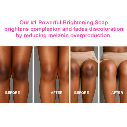 10-in-1 Powerful Brightening Turmeric Lemon & Kojic Acid Soap (Face & Body) – Natural Scented Options